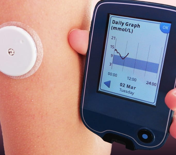A cgm
